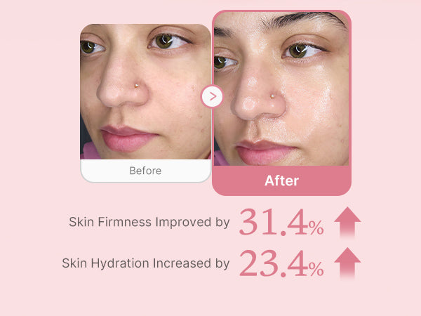 Hydrated and Firm Skin in 2 weeks of usage.