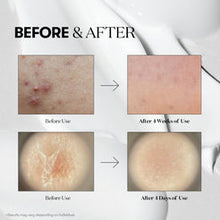 VT COSMETICS VT Reedle Shot 100 Serum | authentic Korean Skincare in UAE