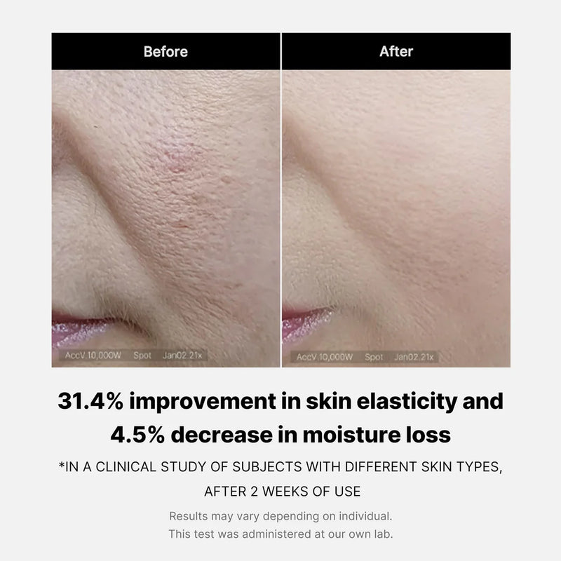 Improves Skin Elasticity in just 2 Weeks