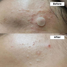 NINELESS A - Control 10% Azelaic Acid Serum 30 ml – Korean serum for Acne and Pigmentation Treatment – Korean - Skincare Arabia