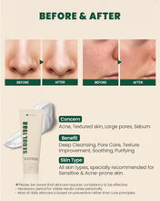 K - SECRET Seoul 1988 Pine Cica Cleansing Foam 150ml – Soothing Korean Face Wash with Probiotics for Sensitive Skin – Korean - Skincare Arabia