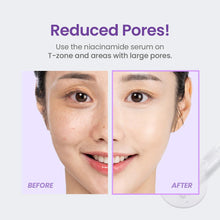 TIRTIR Niacinamide 20% Serum 30ml – Korean Niacinamide serum for Pore Refining and Brightening – Korean - Skincare Arabia